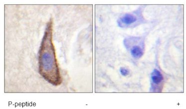Immunohistochemistry analysis of paraffin-embedded human brain tissue using ab61790 at 1/50-1/100 dilution with (+) or without (-) immunising phosphopeptide. 