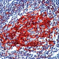 ab17142 staining human tonsil by IHC-P.