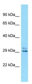 Anti- EID2 antibody (ab125373) at 1 µg/ml + Mouse kidney lysate at 10 µg