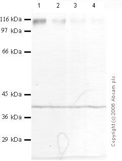All lanes : Anti-CD26 antibody (ab28339) at 1/1000 dilutionLane 1 : Recombinant Human DPP-4 at 0.08 µgLane 2 : Recombinant Human DPP-4 at 0.04 µgLane 3 : Recombinant Human DPP-4 at 0.02 µgLane 4 : Recombinant Human DPP-4 at 0.01 µg