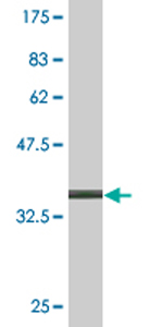 Anti-ACTRT2 antibody (ab77418) at 5 µg/ml + immunogen (tagged 91 aa recombinant fragment) at 0.1 µgSecondaryGoat anti-mouse IgG (H&L) HRP-conjugated at 1/5000 dilution