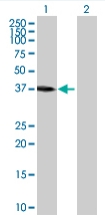 All lanes : Anti-ACTRT2 antibody (ab68046) at 1/500 dilutionLane 1 : ACTRT2 transfected 293T cell lysateLane 2 : Non transfected 293T cell lysateLysates/proteins at 25 µg per lane.SecondaryGoat anti-mouse IgG (H&L)-HRP conjugate at 1/2500 dilution