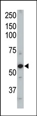 Anti-ACVRL1 antibody (ab37807) at 1/100 dilution + mouse heart tissue lysate