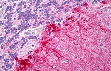 Immunohistochemical analysis of Formalin-Fixed, Paraffin-Embedded Human Brain, Cerebellum tissue labelling Activin Receptor Like Kinase 1 with ab131132 at 5 µg/ml.