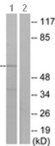 All lanes : Anti-ACVRL1 antibody (ab131132) at 1/500 dilutionLane 1 : K562 cell extractLane 2 : K562 cell extract with synthesized peptide