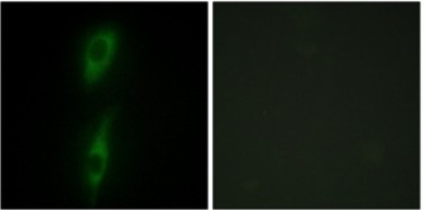 Immunofluorescence analysis of HeLa cells labelling Activin Receptor Like Kinase 1 with ab131132 at 1/100 dilution. The image on the right is treated with the synthesized peptide.