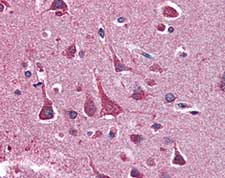 ab105326, at 10 µg/ml, staining 14-3-3 Tau in formalin-fixed, paraffin-embedded Human Brain, Cortex by Immunohistochemistry, using a biotinylated anti-mouse IgG secondary antibody, alkaline phosphatase-streptavidin and chromogen.