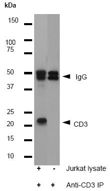 Western blot analysis of immunoprecipitation pellets from Jurkat cell lysate or PBS (lane 2: negative control), using ab32186 at a 1/50 dilution. The predicted band size of 23 kDa was observed.
