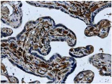 ab51870 at 1/50 dilution staining ACVRL1 in Human placental tissue section by Immunohistochemistry (Formalin/PFA fixed paraffin-embedded sections).