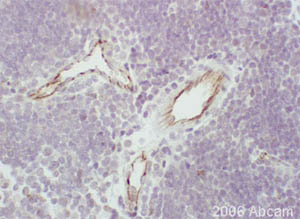 Anti-CD31 antibody (ab28364) at 1/50 dilution staining mouse tissue sections by Immunohistochemistry (Formalin-fixed paraffin-embedded sections). Folowing heat mediated antigen retrieval the tissue was formaldehyde fixed and blocked with serum. The tissue was incubated with the primary antibody for 20 minutes. A biotinylated goat anti-rabbit antibody was used as the secondary. The endothelium of vessels of any tissues are positive.See Abreview