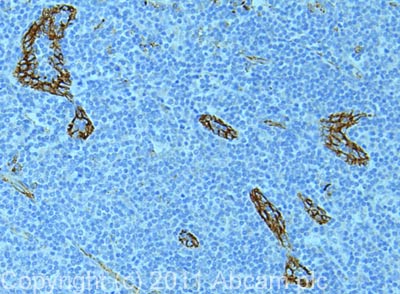 IHC image of ab32457 staining in human tonsil formalin fixed paraffin embedded tissue section, performed on a Leica BondTM system using the standard protocol F. The section was pre-treated using heat mediated antigen retrieval with sodium citrate buffer (pH6, epitope retrieval solution 1) for 20 mins. The section was then incubated with ab32457, 5µg/ml, for 15 mins at room temperature and detected using an HRP conjugated compact polymer system. DAB was used as the chromogen. The section was then counterstained with haematoxylin and mounted with DPX. For other IHC staining systems (automated and non-automated) customers should optimize variable parameters such as antigen retrieval conditions, primary antibody concentration and antibody incubation times