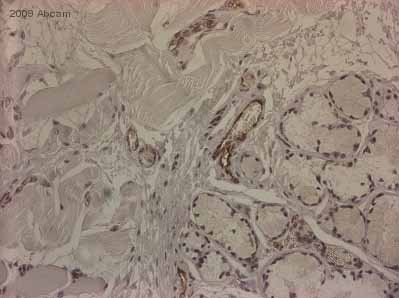 ab32457 staining CD31 in human tonsil tissue section by Immunohistochemistry (Formalin/PFA-fixed paraffin-embedded sections). Tissue underwent fixation in formaldehyde, heat mediated antigen retrieval in Citrate buffer pH 6.0 and blocking (5 minutes/peroxidase block then 10 minutes/protein block) for 15 minutes at 20°C. The primary antibody was diluted, 1/2000 and incubated with sample for 45 minutes at 20°C. A HRP conjugated goat polyclonal to rabbit IgG was used undiluted as secondary.See Abreview