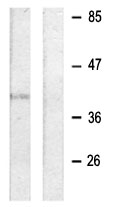 All lanes : Anti-CD32 antibody (ab63616) at 1/500 dilutionLane 1 : Jurkat cells treated with PMA (125ng/ml, 30mins)Lane 2 : Jurkat cells treated with PMA (125ng/ml, 30mins) with immunising peptide at 10 µgLysates/proteins at 30 µg per lane.