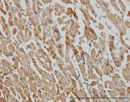 Acyl-CoA Thioesterase 9 antibody (ab57174) used in immunohistochemistry at 3ug/ml on formalin fixed and paraffin embedded human heart.