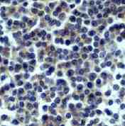 Ab45143 staining human CD32 (1/100) in human lymph node by immunohistochemistry using paraffin embedded tissue.