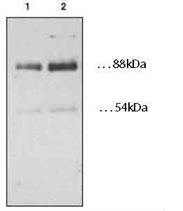 All lanes : Anti-CD36 antibody (ab78054)Lane 1 : Lysate prepared from human platelets at 15 µgLane 2 : Lysate prepared from human platelets at 30 µg