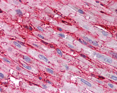 Immunohistochemical analysis of formalin-fixed, paraffin-embedded Human heart tissue, staining CD36 with ab78054 at 5 µg/ml. A heat induced antigen retrieval step was performed using pH 6.0 citrate buffer. After incubation with the primary antibody, slides were incubated with biotinylated secondary antibody, followed by alkaline phosphatase-streptavidin and chromogen.