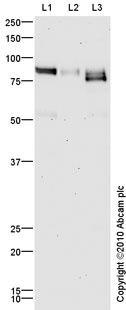 All lanes : Anti-CD36 antibody (ab64014) at 1 µg/mlLane 1 : Human Platelet (Human adult normal cell line) Whole Cell Lysate Lane 2 : Spleen (Human) Tissue Lysate - adult normal tissue (ab29699)Lane 3 : Adipose (Human) Total Protein Lysate - adult normal tissue (ab28980)Lysates/proteins at 10 µg per lane.SecondaryGoat polyclonal to Rabbit IgG - H&L - Pre-Adsorbed (HRP) at 1/3000 dilutiondeveloped using the ECL techniquePerformed under reducing conditions.