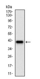 Anti-CD36 antibody [5B6B2] (ab202023) at 1/500 dilution + Human CD36 (aa: 30-130) recombinant protein at 1 µg