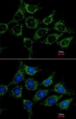 ab137616 at 1/500 dilution staining Acylglycerol Kinase in methanol fixed Hep3B cells by Immunofluorescence. Lower image costained with Hoerchst 33342.