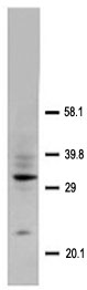 Anti-CD40L antibody (ab65854) at 2 µg/ml + Rat spleen 