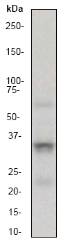 Anti-CD40L antibody [EP462E] (ab52750) at 1/5000 dilution + MOLT-4 cell lysate at 10 µgSecondaryGoat anti-rabbit HRP labeled at 1/2000 dilution