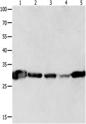 All lanes : Anti-14-3-3 theta antibody (ab183075) at 1/300 dilutionLane 1 : mouse brain tissue lysateLane 2 : Human A549 cell lysateLane 3 : Human lymphoma tissue lysateLane 4 : mouse NIH 3T3 cell lysateLane 5 : Human colon cancer tissue lysateLysates/proteins at 40 µg per lane.SecondaryGoat anti Rabbit IgG - H&L (HRP) at 1/10000 dilutiondeveloped using the ECL technique