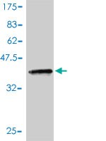 Western blot against tagged recombinant protein immunogen using ab54962 ACYP1 antibody at 1ug/ml.