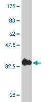Western blot against tagged recombinant protein immunogen using ab54964 ACYP2 antibody at 1ug/ml.