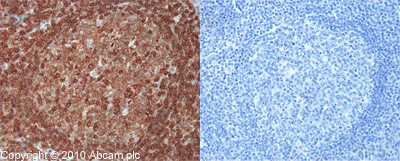ab10558 (1:40) staining CD45 in paraffin-embedded human tonsil (left panel) using an automated system (Ventana Discovery). Right-hand panel shows negative control (no primary antibody). Using this protocol there is strong membrane staining of B cells in the germinal centres and mantle zone of the follicles and scattered cells of the interfollicular areas (paracortical T and B cells). There is a mild to moderate degree of cytoplasmic staining associated with the membrane staining in these specific cells.Sections were rehydrated and antigen retrieved in CC1 Cell Conditioning Buffer using Ventana Extended Retrieval programme. Slides were blocked in 3% H2O2 /4 min/ 37°C and incubated with ab10558 (1:40 dilution / 1 hour/ 37°C). Sections then blocked (4mins/ 37°C) and incubated with Dako swine anti-rabbit antibody (1:50, 28 min/ 37°C). Staining was amplified and detected by incubation with Ventana Streptavidin ABC system (16 min/ 37°C) and Ventana DAB map reagent (8 min/ 37°C). Slides were