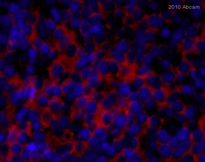 ab10558 staining CD45 in fetal mouse liver tissue sections 12.5 dpc by Immunohistochemistry (frozen sections). Tissue was fixed with paraformaldehyde and a permeabilization step was performed using 0.1% Tween-20. Samples were then blocked with 5% BSA for 1.5 hours at 20°C followed by incubation with the primary antibody at a 1/150 dilution, for 16 hours at 4°C. A Goat anti-rabbit Alexa Fluor® 594 polyclonal was used as the secondary antibody at a 1/1500 diution.See Abreview
