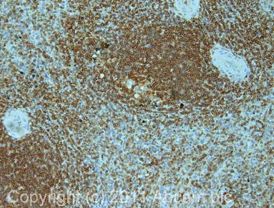 IHC image of CD45 staining in human spleen formalin fixed paraffin embedded tissue section, performed on a Leica BondTM system using the standard protocol F. The section was pre-treated using heat mediated antigen retrieval with sodium citrate buffer (pH6, epitope retrieval solution 1) for 20 mins. The section was then incubated with ab10558, 1µg/ml, for 15 mins at room temperature and detected using an HRP conjugated compact polymer system. DAB was used as the chromogen. The section was then counterstained with haematoxylin and mounted with DPX.