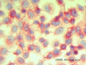 ab3283 at 1µg/ml staining CD47 from human OVCA3 cells by ICC. The cells were methanol fixed, blocked with 3% serum and incubated with the primary antibody for 30 minutes. A biotinylated horse anti-mouse IgG was used as the secondary antibody.See Abreview