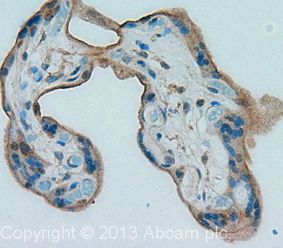IHC image of CD59 staining in Human normal placenta formalin fixed paraffin embedded tissue section, performed on a Leica Bond™ system using the standard protocol F. The section was pre-treated using heat mediated antigen retrieval with sodium citrate buffer (pH6, epitope retrieval solution 1) for 20 mins. The section was then incubated with ab69084, 0.1µg/ml, for 15 mins at room temperature and detected using an HRP conjugated compact polymer system. DAB was used as the chromogen. The section was then counterstained with haematoxylin and mounted with DPX. For other IHC staining systems (automated and non-automated) customers should optimize variable parameters such as antigen retrieval conditions, primary antibody concentration and antibody incubation times.