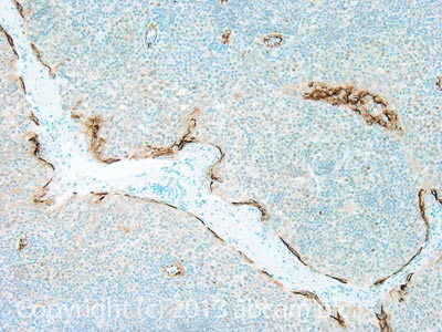 IHC image of CD62P staining in Human tonsil formalin fixed paraffin embedded tissue section, performed on a Leica BondTM system using the standard protocol F. The section was pre-treated using heat mediated antigen retrieval with sodium citrate buffer (pH6, epitope retrieval solution 1) for 20 mins. The section was then incubated with ab119435, 0.5µg/ml, for 15 mins at room temperature and detected using an HRP conjugated compact polymer system. DAB was used as the chromogen. The section was then counterstained with haematoxylin and mounted with DPX. For other IHC staining systems (automated and non-automated) customers should optimize variable parameters such as antigen retrieval conditions, primary antibody concentration and antibody incubation times.