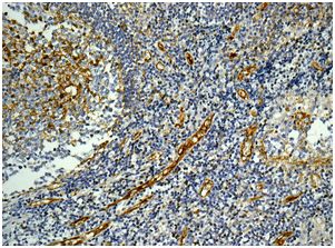 Immunohistochemical analysis of paraffin-embedded Human tonsil tissue labeling CD62P with ab178424 at 1/50 dilution.