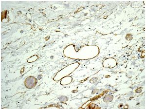 Immunohistochemical analysis of paraffin-embedded Human vessel tissue labeling CD62P with ab178424 at 1/50 dilution.
