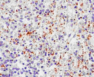 Immunohistochemical analysis of paraffin-embedded Human spleen tissue labeling CD62P with ab182135 at 1/500 dilution followed by pre-diluted HRP-conjugated secondary antibody and counter-stained with Hematoxylin.