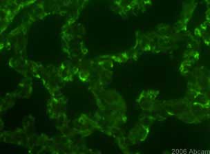 ab955 at a 1/2000 dilution staining CD68 from mouse lung tissue sections (new born pups) by immunohistochemistry (frozen sections). The antibody was incubated with the tissue for 24 hours and then detected using an Alexa-Fluor® 488 Goat anti-mouse IgG. The negative control was secondary antibody alone.See Abreview