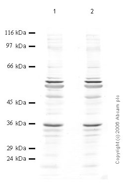 All lanes : Anti-ADAM11 antibody (ab56101) at 1/1000 dilutionLane 1 : TERA cell lysate at 25 µlLane 2 : TERA cell lysate at 20 µl
