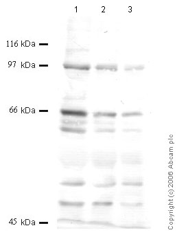 All lanes : Anti-ADAM11 antibody (ab56106) at 1/1000 dilutionLane 1 : Rat brain lysate at 20 µlLane 2 : Rat brain lysate at 10 µlLane 3 : Rat brain lysate at 5 µl