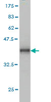 Western blot against tagged recombinant protein immunogen using ab56366 ADAM12 antibody at 1ug/ml.