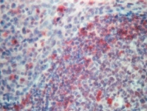 Human tonsil stained with ab5691.