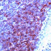 ab74460, at 1/200 dilution, staining CD79a in human tonsil by Immunohistochemistry using formalin-fixed, paraffin-embedded tissue.