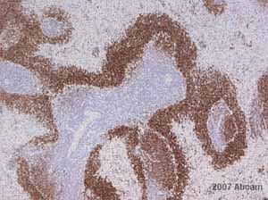 ab3121 at 1/200 staining rat lymphoid tissues sections (Spleen, Lymph Node, Payers Patch) by IHC-P. The tissue was formaldehyde fixed and blocked before incubation with the antibody for 1 hour. A rabbit anti-mouse antibody was used as the secondary.See Abreview