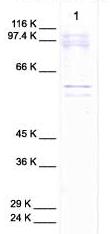 Anti-ADAM15 antibody - Cytoplasmic domain (ab39159) at 1/1000 dilution + cell media from human chondrosarcoma (treated with retinoic acid)