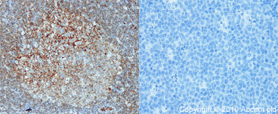ab64116 (1:40) staining CD80 in paraffin-embedded mouse lymph node tissue (left panel) using an automated system (Ventana Discovery). Right-hand panel shows negative control (no primary antibody). Using this protocol there is strong membrane staining, of activated B cells in the germinal centres. What appear to be scattered activated B cells or possibly plasma cells in the interfollicular areas of the lymph node and blood vessels.Sections were rehydrated and antigen retrieved in CC1 Cell Conditioning Buffer using Ventana Extended Retrieval programme. Slides were blocked in 3% H2O2 / 4 min / 37°C and incubated with ab64116 (1:40 dilution / 1 hour / 37°C). Sections then blocked (4mins / 37°C) and incubated with Dako swine anti-rabbit antibody (1:50, 28 min / 37°C). Staining was amplified and detected by incubation with Ventana Streptavidin ABC system (16 min / 37°C) and Ventana DAB map reagent (8 min / 37°C). Slides were counterstained with Haematoxylin and coverslipped in DPX.For man