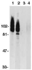 All lanes : Anti-ADAM17 antibody (ab2051) at 1/500 dilutionLane 1 : HeLa whole cell lysate with absence of blocking peptideLane 2 : Jurkat whole cell lysate with absence of blocking peptideLane 3 : HeLa whole cell lysate with ADAM17 peptide (ab7881)Lane 4 : Jurkat whole cell lysate with ADAM17 peptide (ab7881)