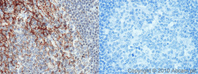 ab66400 (1:80) staining CD82 in paraffin-embedded human tonsil tissue (left panel) using an automated system (Ventana Discovery). Right hand panel shows negative control (no primary antibody).Using this protocol there is strong membrane staining of follicular dendritic cells, and the FDC network forming the structure of germinal centres is clearly highlighted by this antibody. There is associated weak staining of smaller cells in the interfollicar areas which may be T cells.Sections were rehydrated and antigen retrieved in CC1 Cell Conditioning Buffer using Ventana Standard Retrieval programme. Slides were blocked in 3% H2O2 / 4 min / 37°C and incubated with ab66400 (1:80 dilution / 1 hour / 37°C). Sections then blocked (4mins / 37°C) and incubated with Dako swine anti-rabbit antibody (1:50, 28 min / 37°C). Staining was amplified and detected by incubation with Ventana Streptavidin ABC system (16 min / 37°C) and Ventana DAB map reagent (8 min / 37°C). Slides were counterstained with