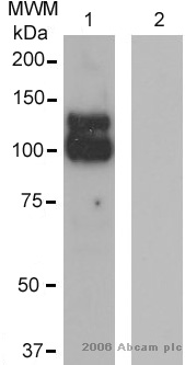 Lane 1 :  Anti-ADAM17 antibody (ab2051) at 0.5 µg/mlLane 2 :  Unrelated antibody of the same subclass as ab2051.Lane 1 : Human keratinocytes (HaCaT)- whole cell lysate from 20000 cellsLane 2 : Human keratinocytes (HaCaT)- whole cell lysate from 20000 cellsSecondaryHRP conjugated goat polyclonal antibodydeveloped using the ECL techniquePerformed under reducing conditions.